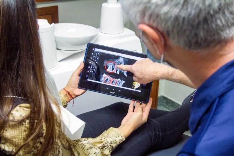 Implanturile dentare necesită îngrijire specială? Photo Dental implant