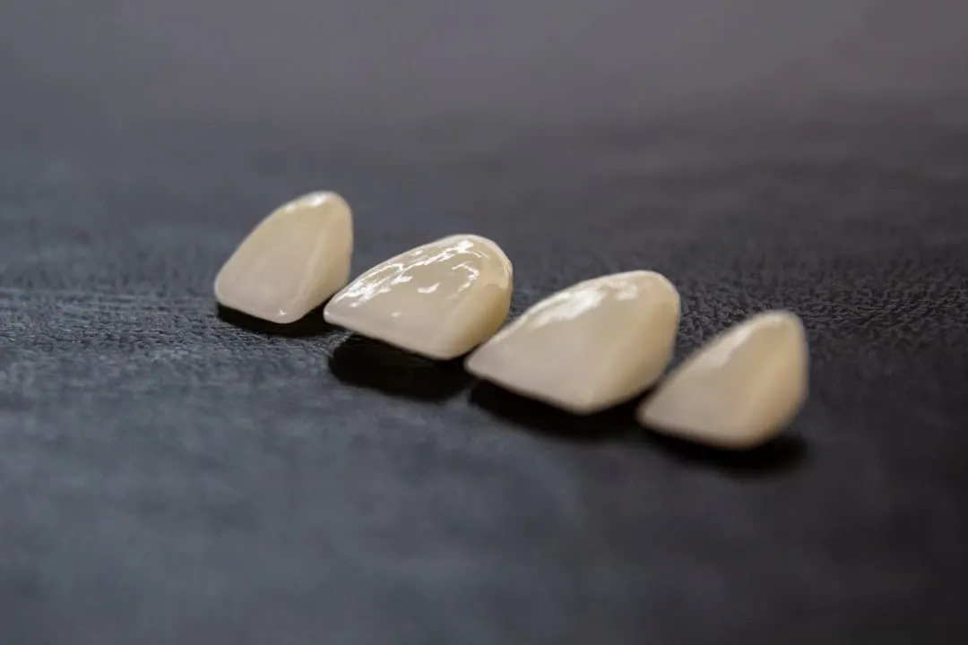 Photo Dental implant