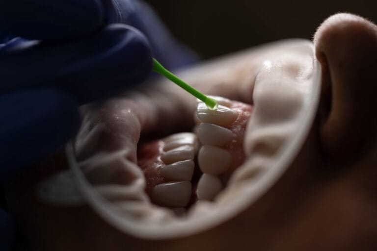 Photo Dental implant types: comparison