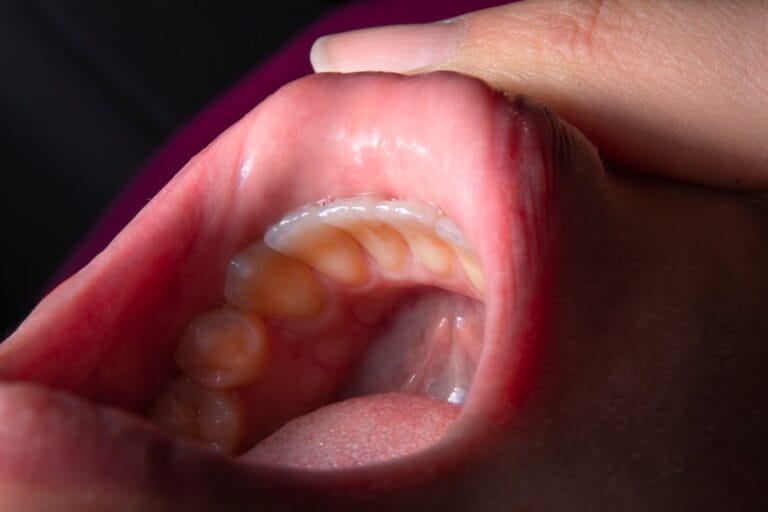 Photo Dental implant