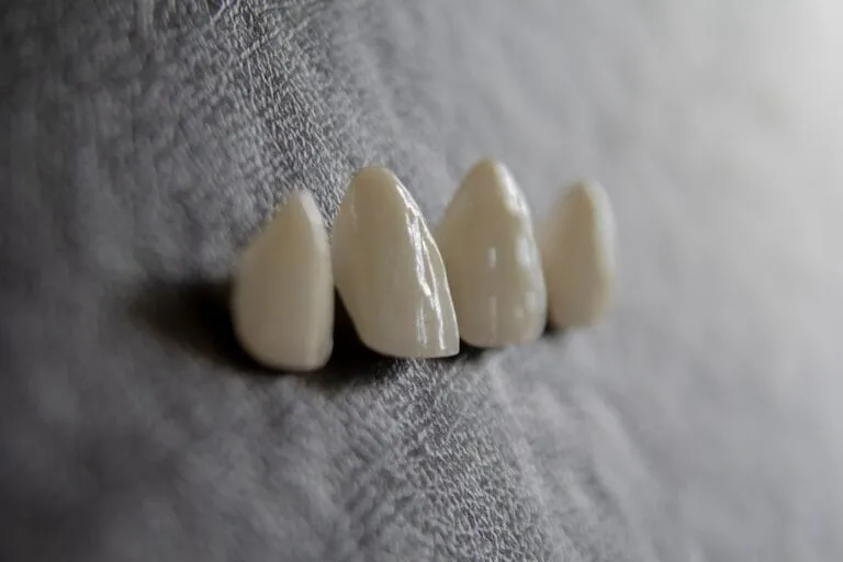 Photo Dental implant