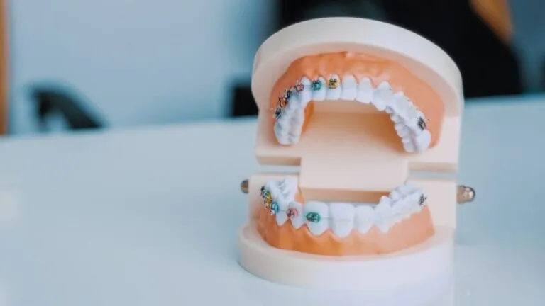 Photo Tooth decay