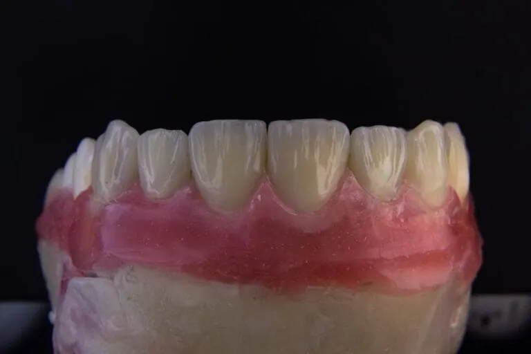 Photo Customized implant