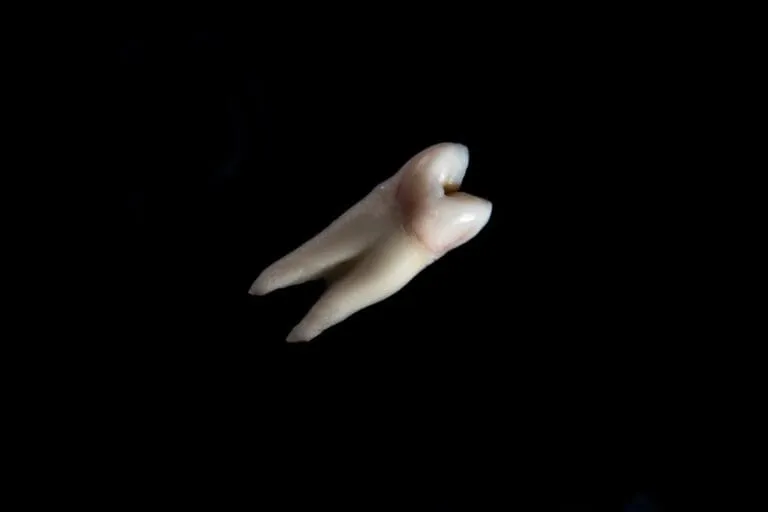 Photo Dental implant