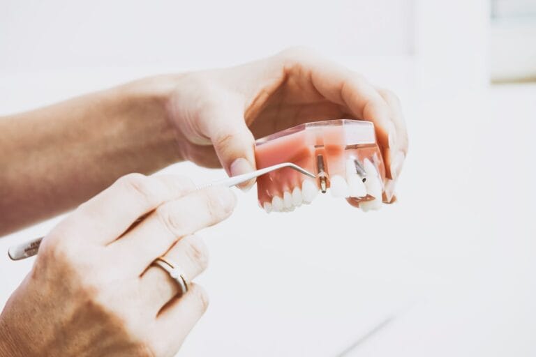 De ce să alegi implanturi dentare pentru un zâmbet natural Photo Dental implant