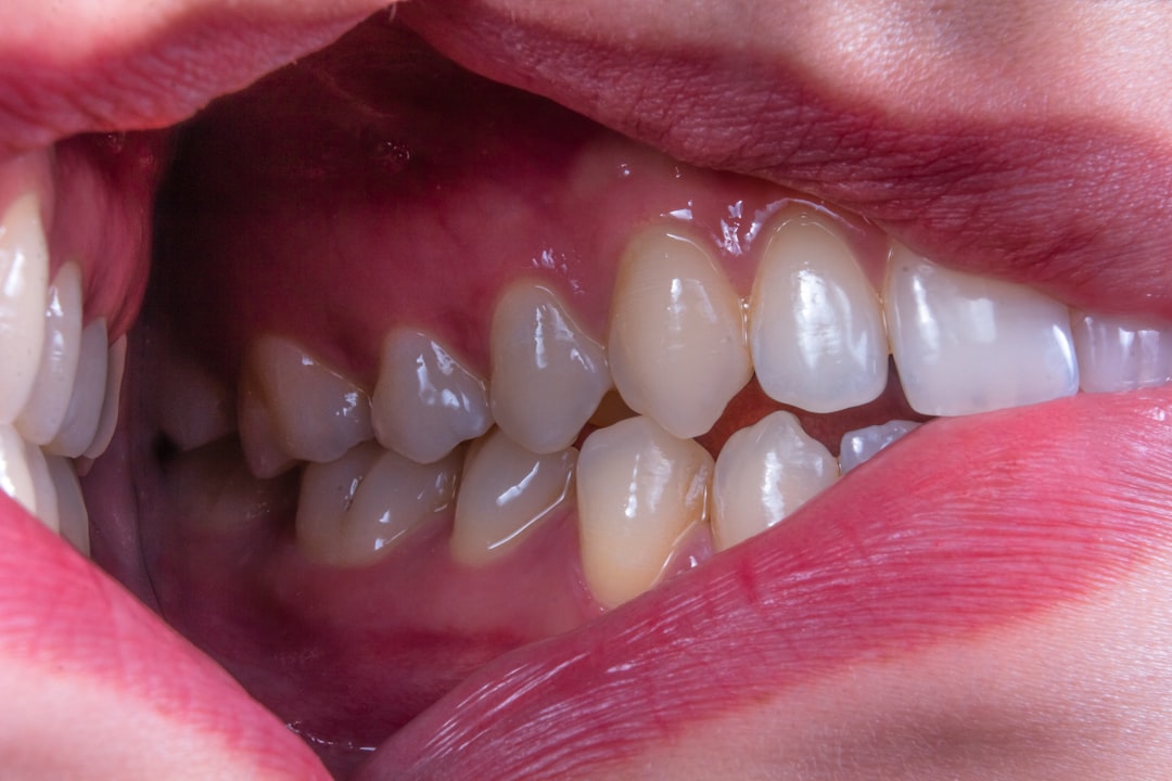 Photo inflamed gums