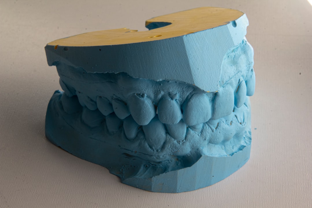 Photo implant dentar