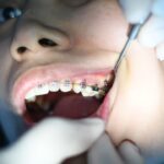 Cum să te pregătești pentru o vizită la dentist