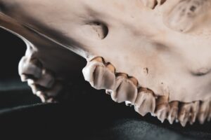 Photo sensitive teeth