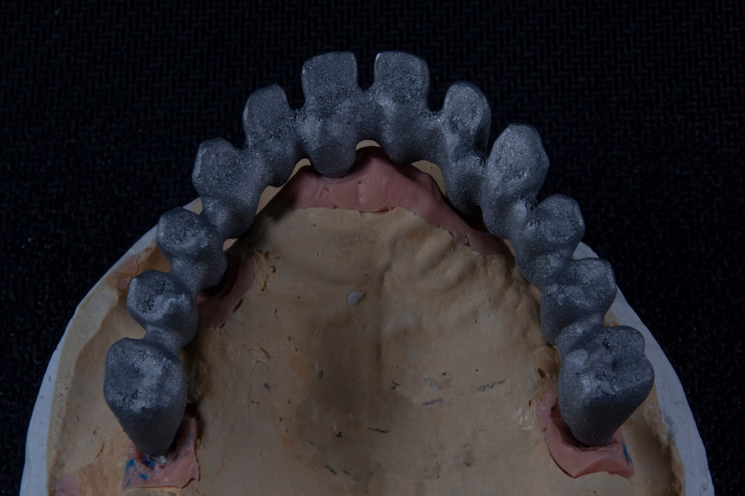 Photo dental prosthetics