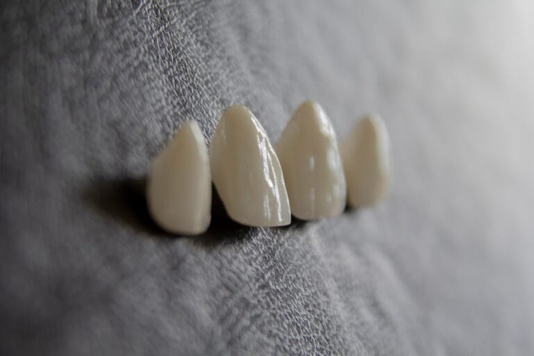 Photo teeth whitening at home safely