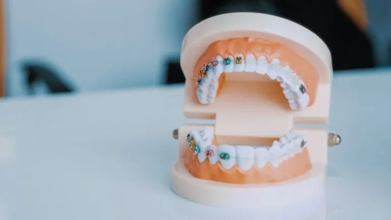 Implanturi dentare: tipuri și diferențe Photo dental implants