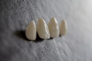 Photo implant dentar