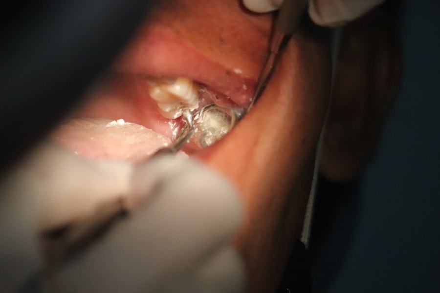 Photo Implant dentar
