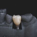 Semnele unui implant dentar respins