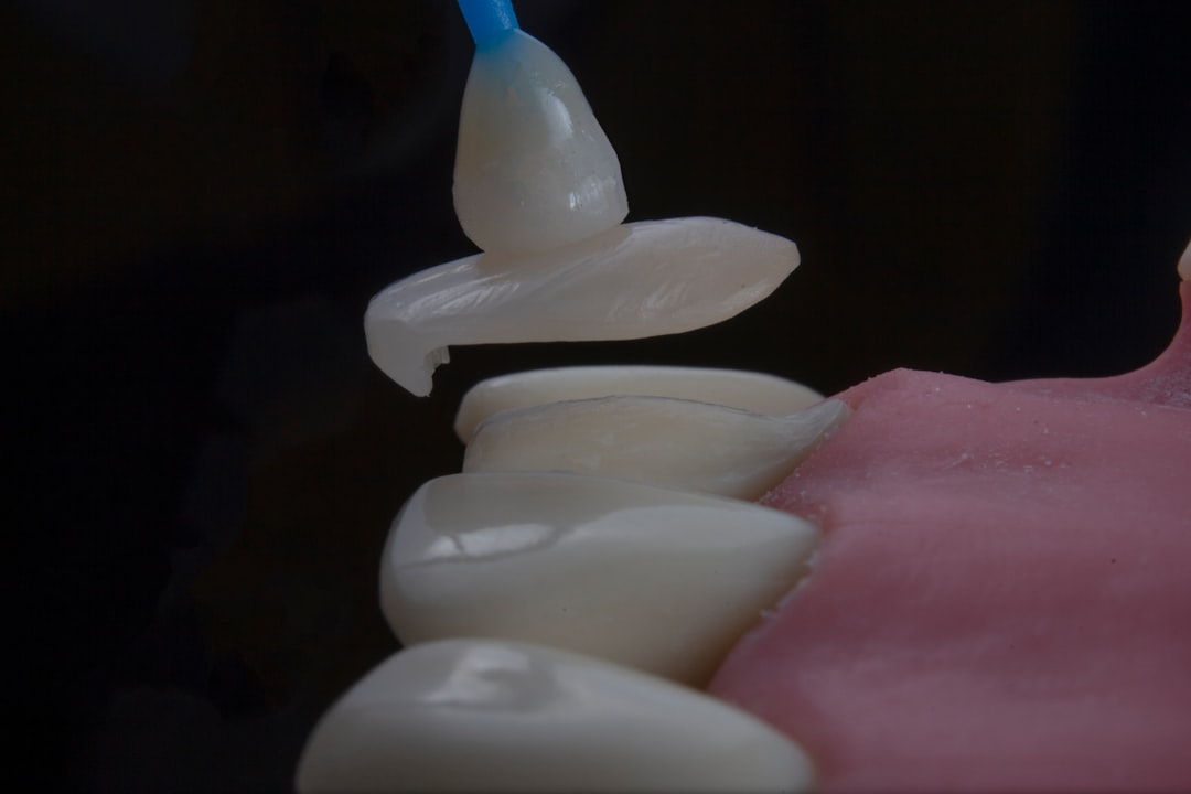 Photo implant insertion procedure stages