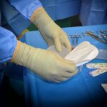 Recuperarea după implant: Durata și procesul