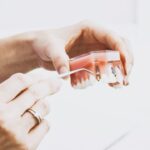Implanturi dentare: tipuri și materiale utilizate