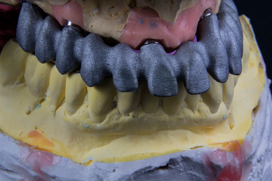 Photo Implant dentar