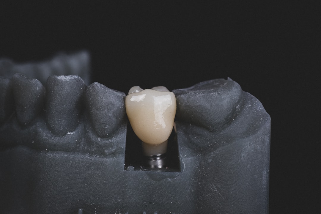 Photo dental implant