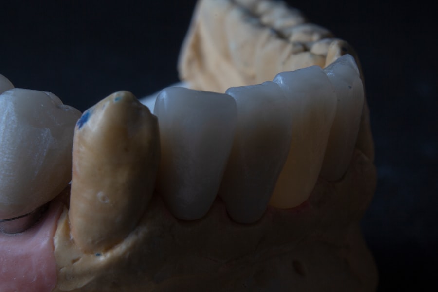 implant success