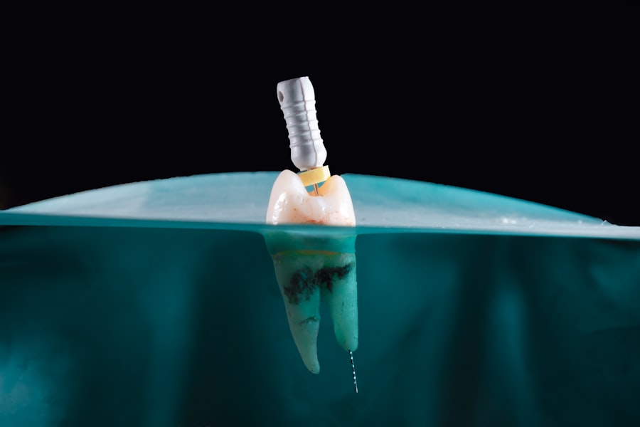 Photo implant success