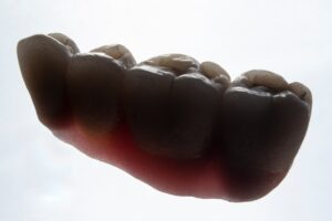 Photo implant success