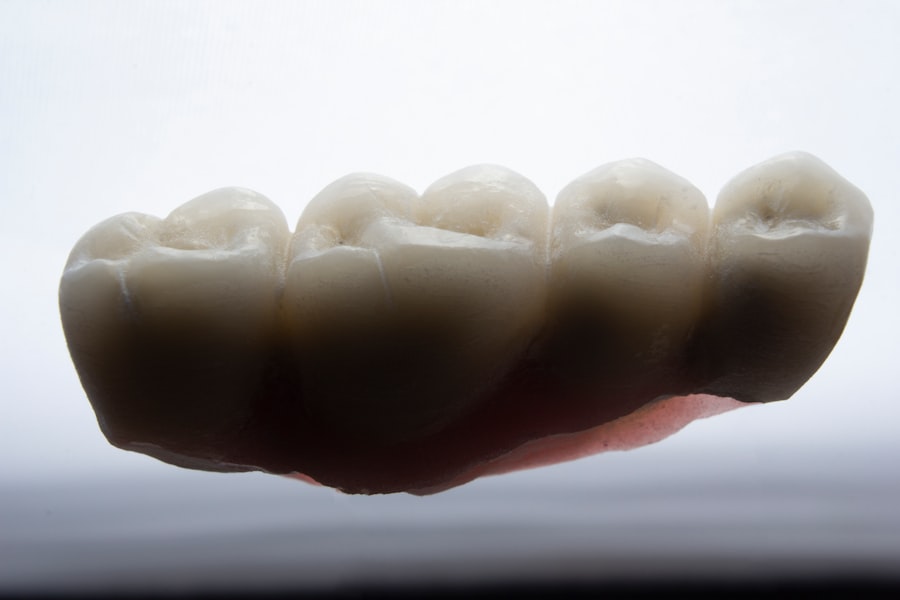 Photo implant success
