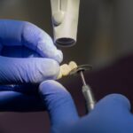 Implanturi dentare pentru pacienții cu parodontoză