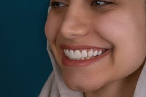 Photo implant dentar