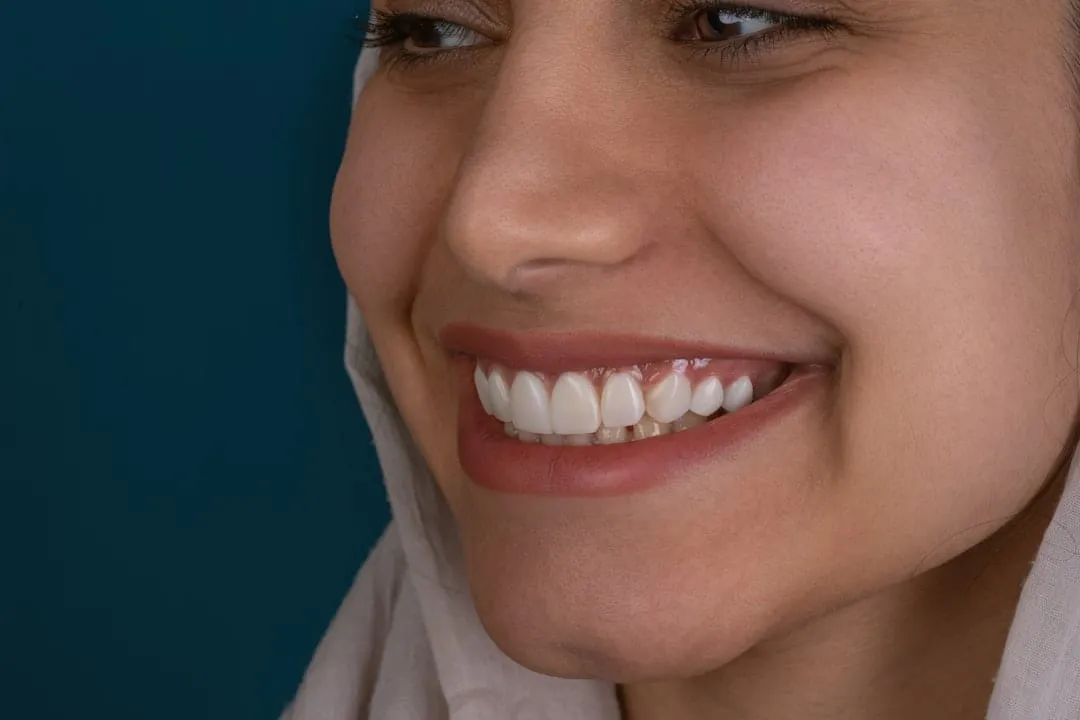 Photo implant dentar