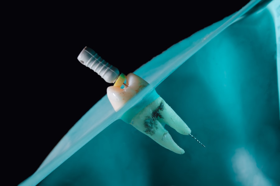 Photo implant dentar