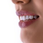 Durata de viață a unui implant dentar de calitate: ce să știi