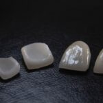 Implanturile dentare: Titan vs. Zirconiu