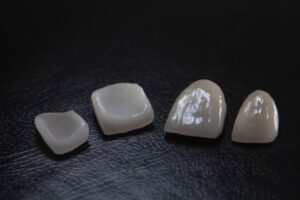 Photo implant differences