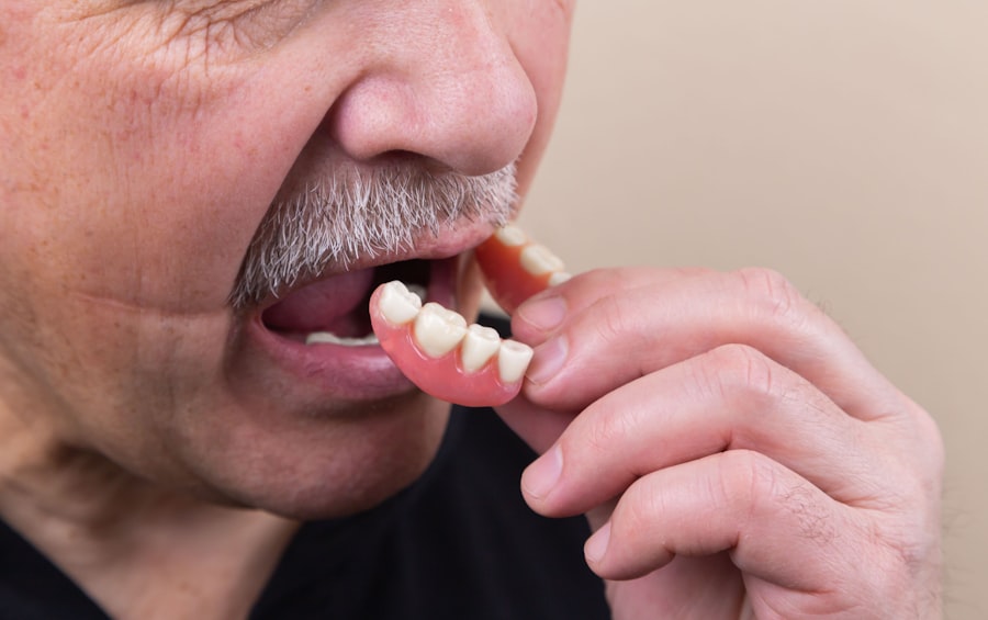 Photo dental implants