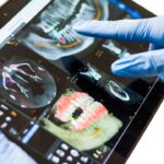 Riscurile și complicațiile în implantologia dentară