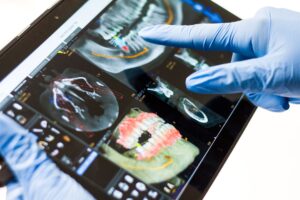 Photo dental implant complications
