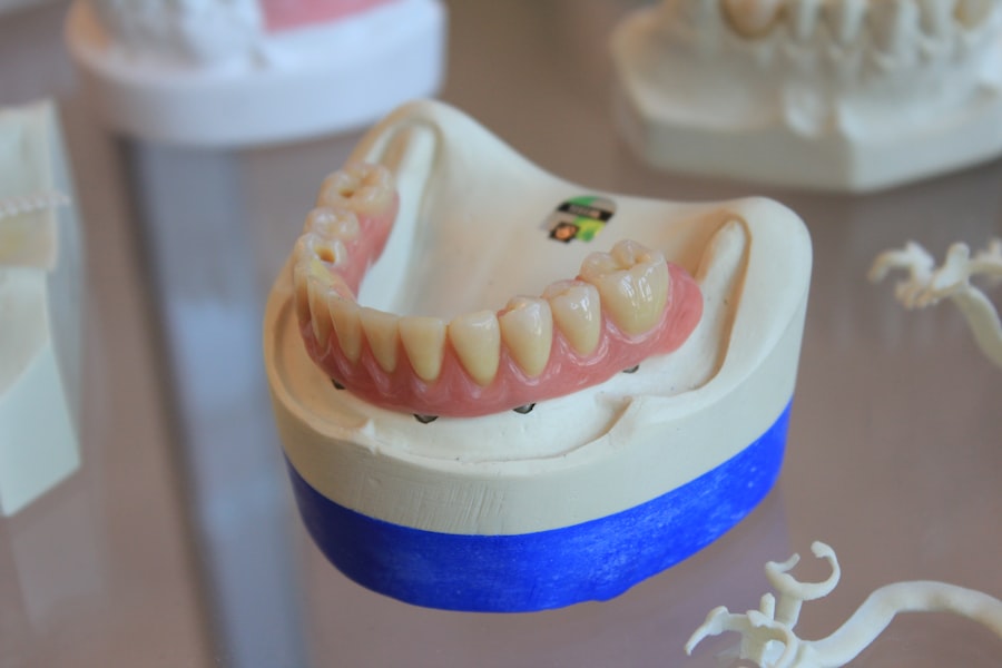 implant dentar
