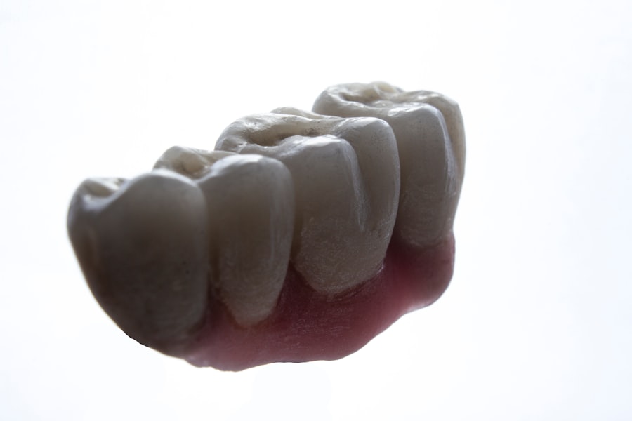 dental implant crown