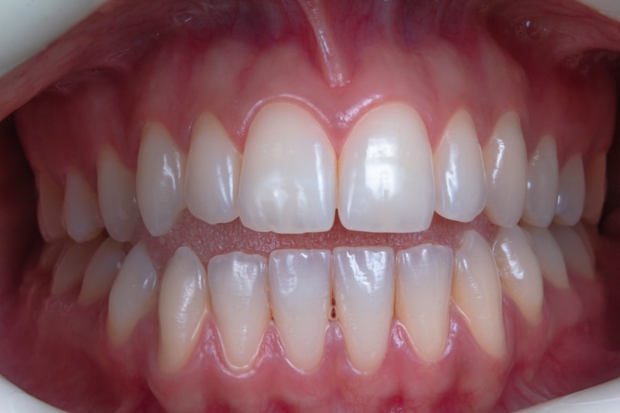Photo implant dentar