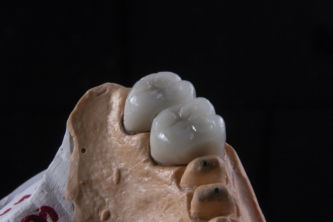 Photo dental crown on implant