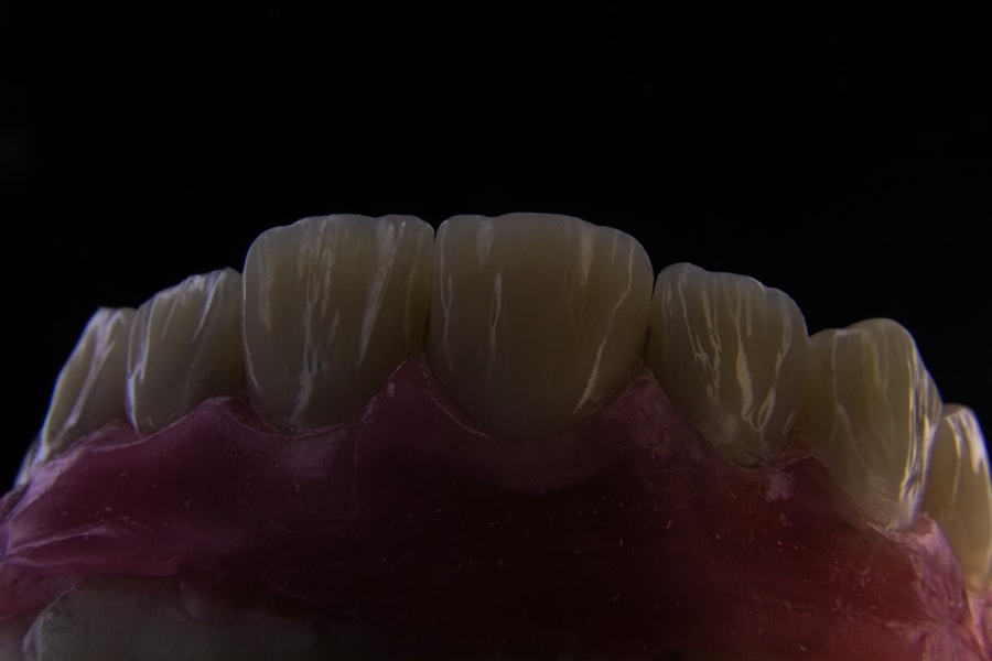 Photo dental implant crown