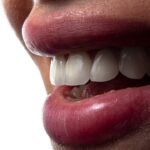 Implant dentar în rate: opțiuni de finanțare disponibile