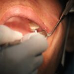 Pregătirea preoperatorie pentru implantologie