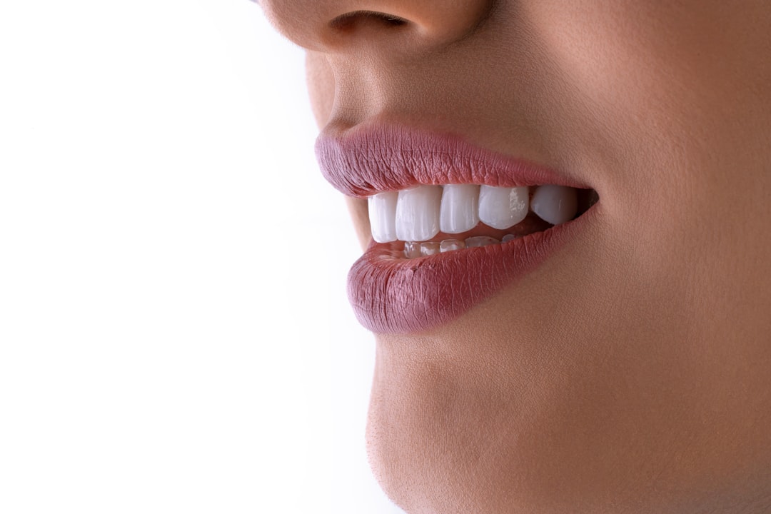 Photo implant dentar