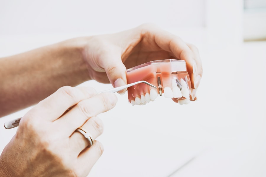 Photo implant dentar