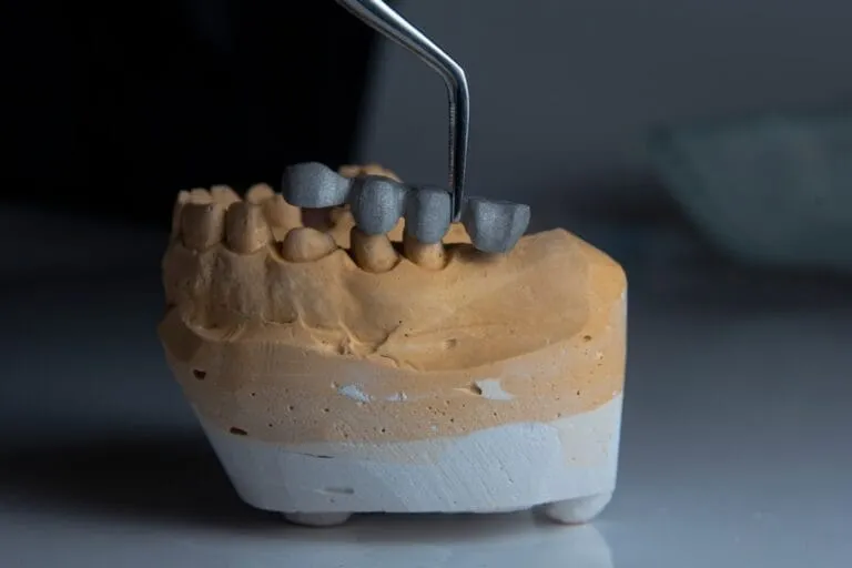 Photo Implant dentar lateral