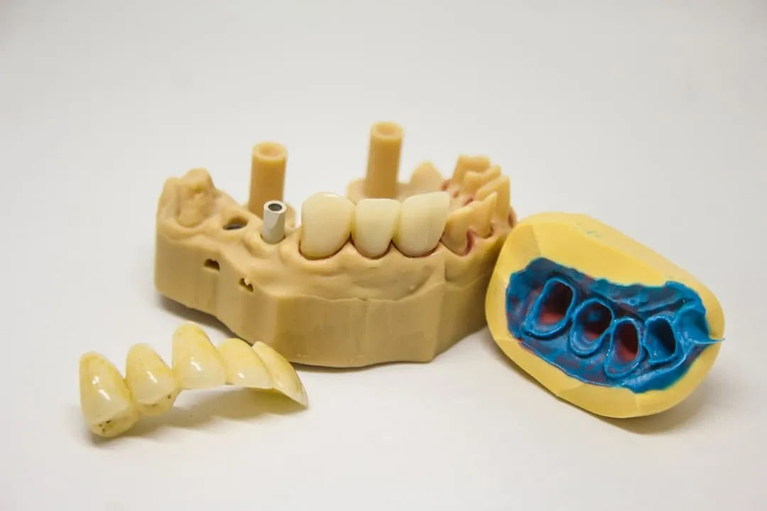 Photo implant dentar