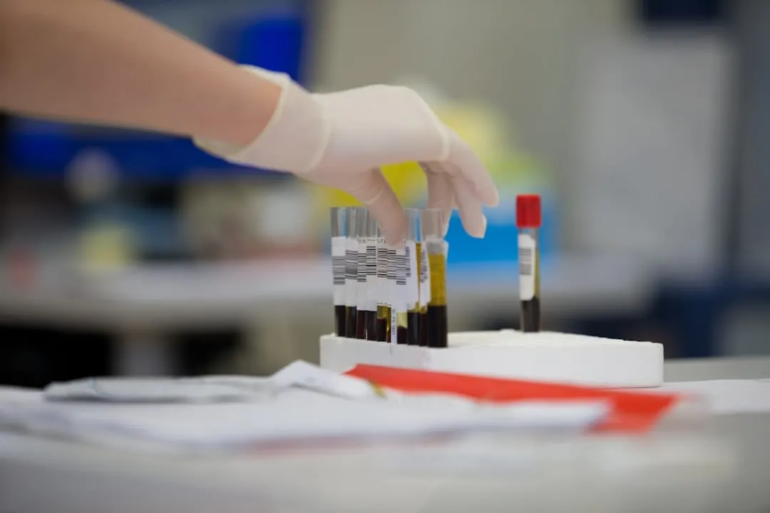 Photo blood tests
